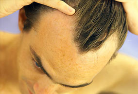 silica hair loss